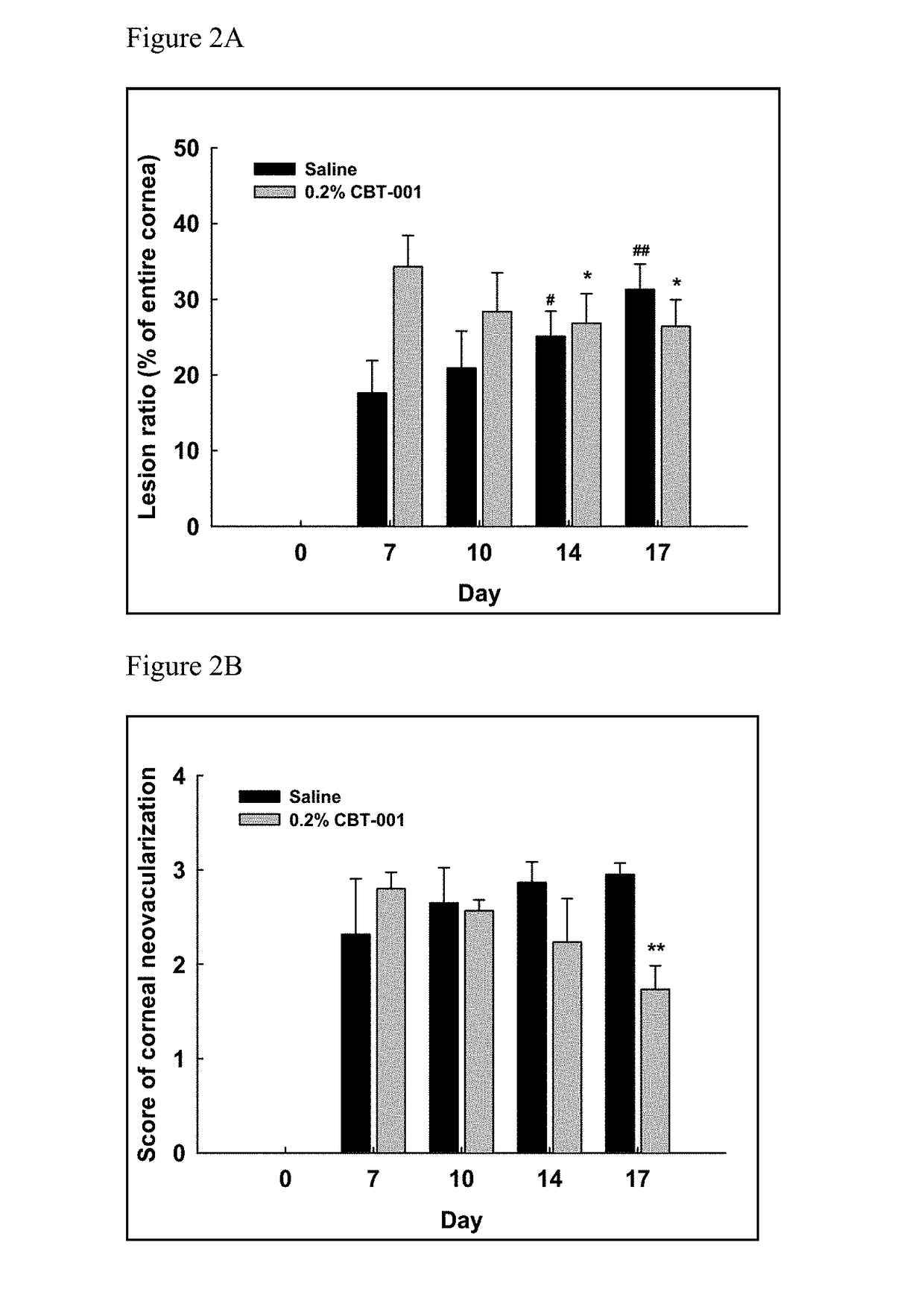 Compositions and methods for treating pterygium