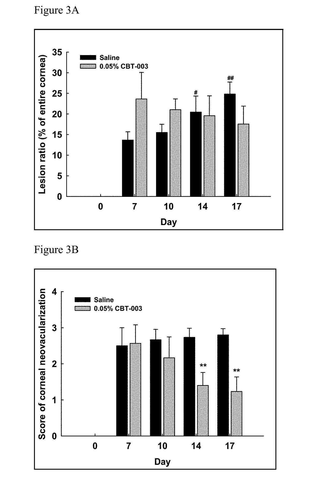 Compositions and methods for treating pterygium