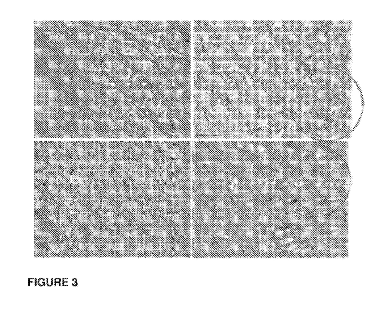 Regeneration of damaged tissue