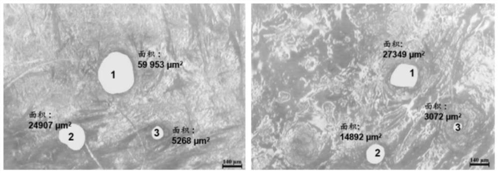 Plant acne-removing composition and application thereof