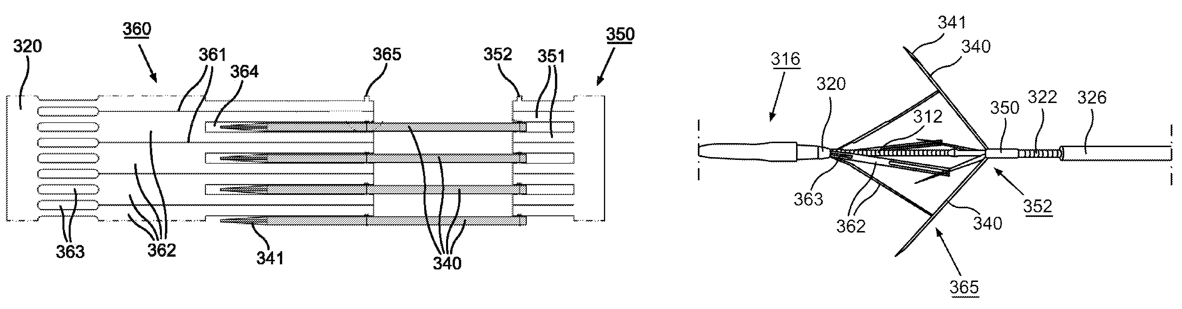 Scoring catheter and method for treating diseased heart valves