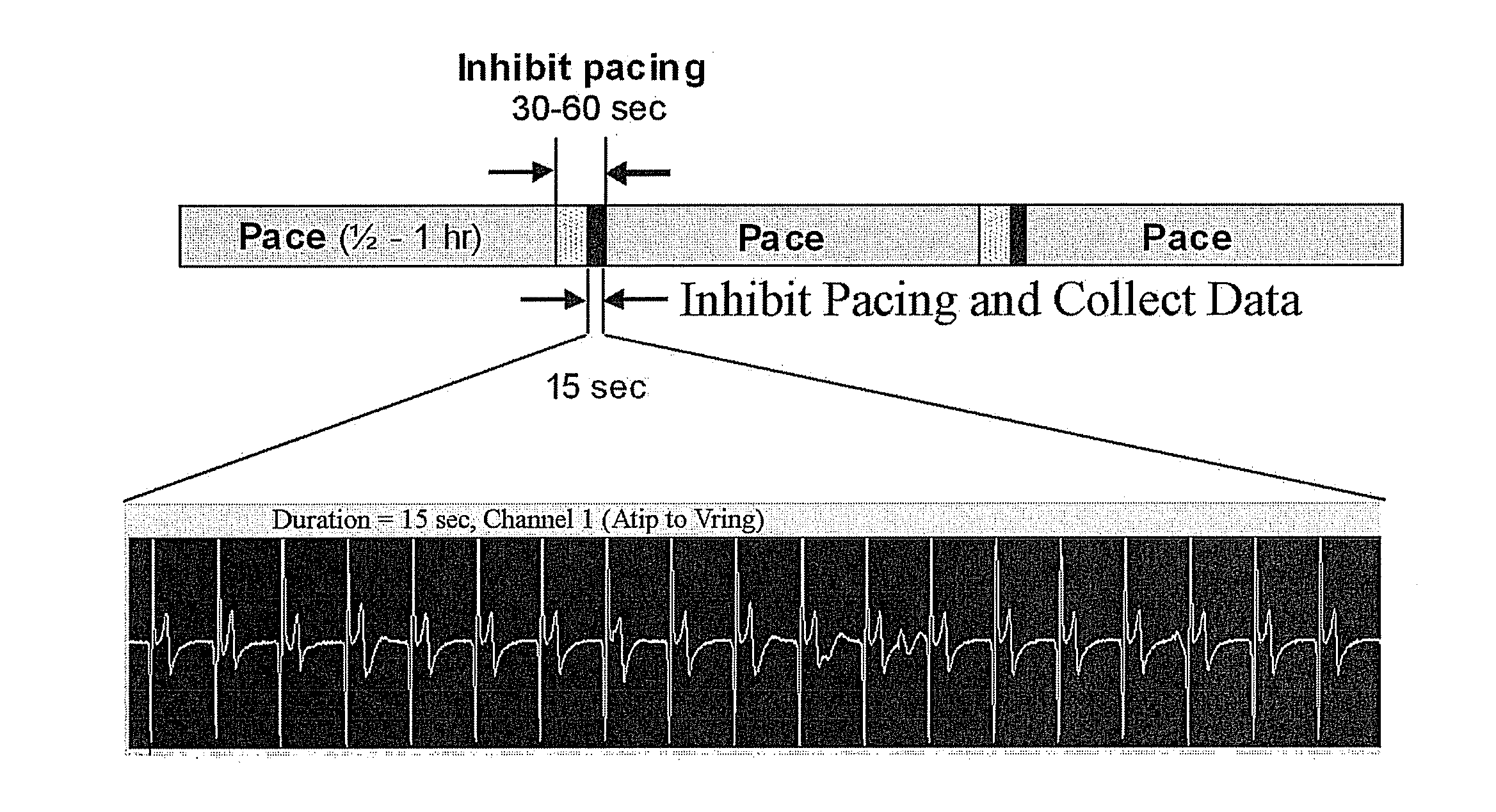 System and apparatus to monitor biopacemaker maturation