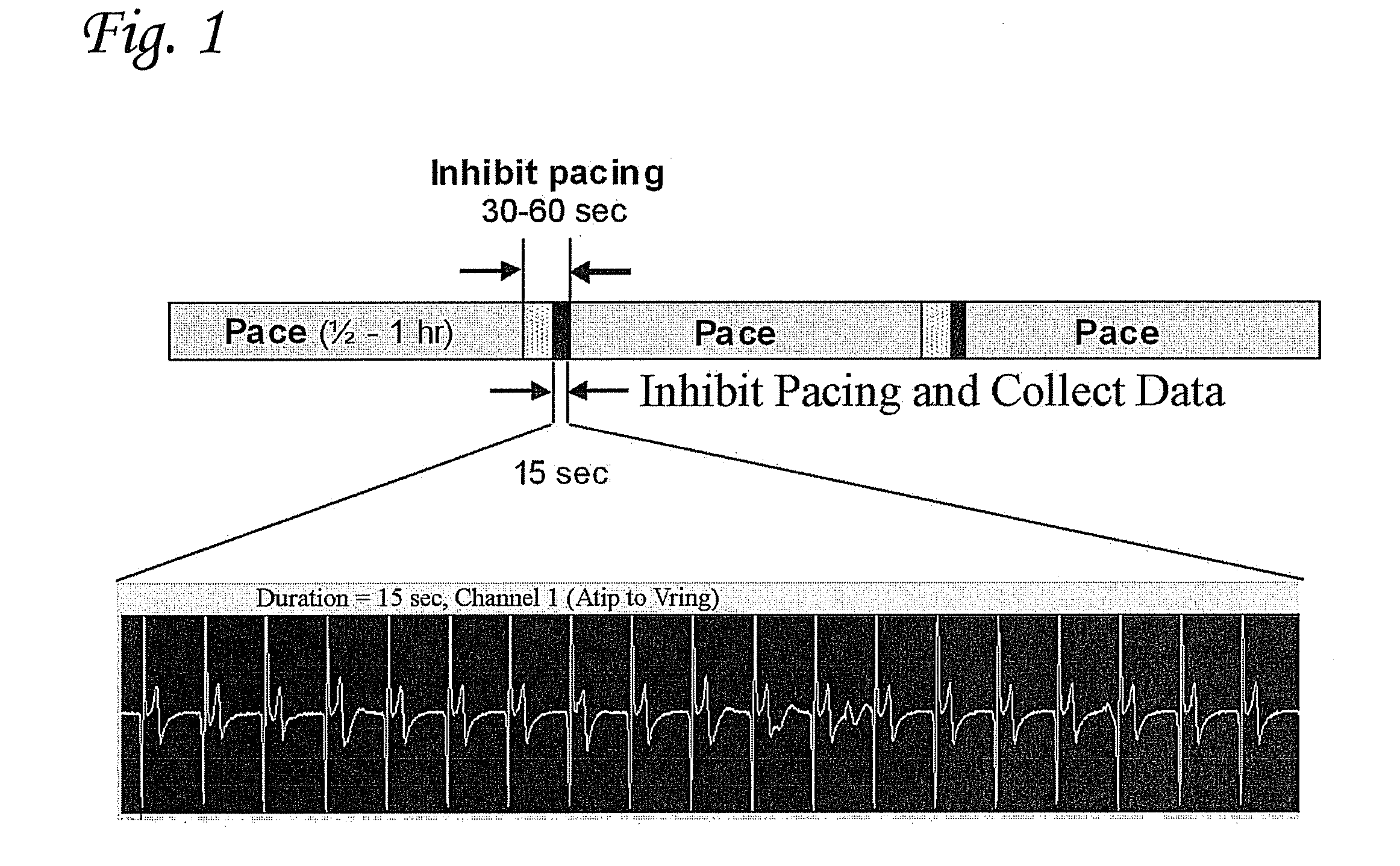 System and apparatus to monitor biopacemaker maturation