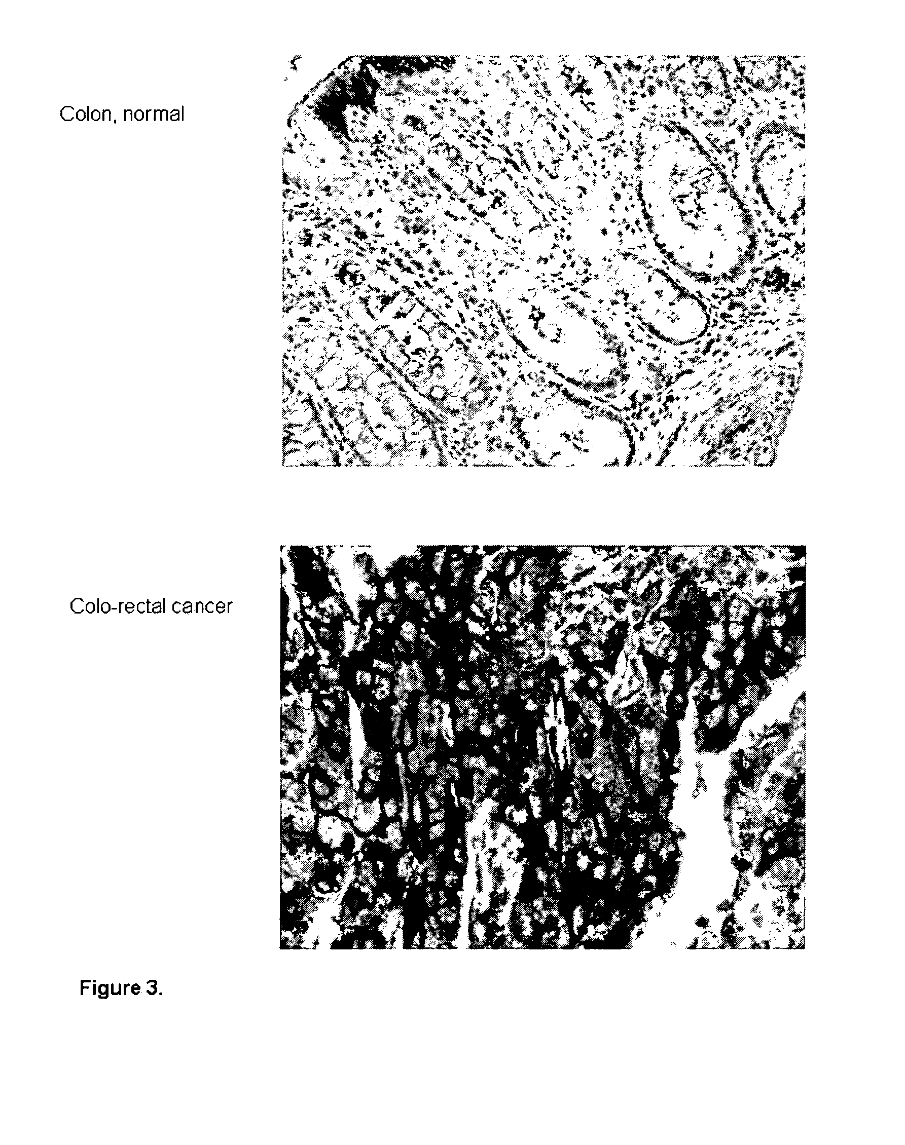 Tumor Marker and Methods of Use Thereof