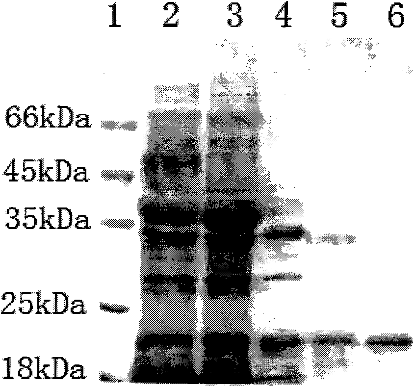 Method for extracting alpha-amylase inhibitor from hulless oat