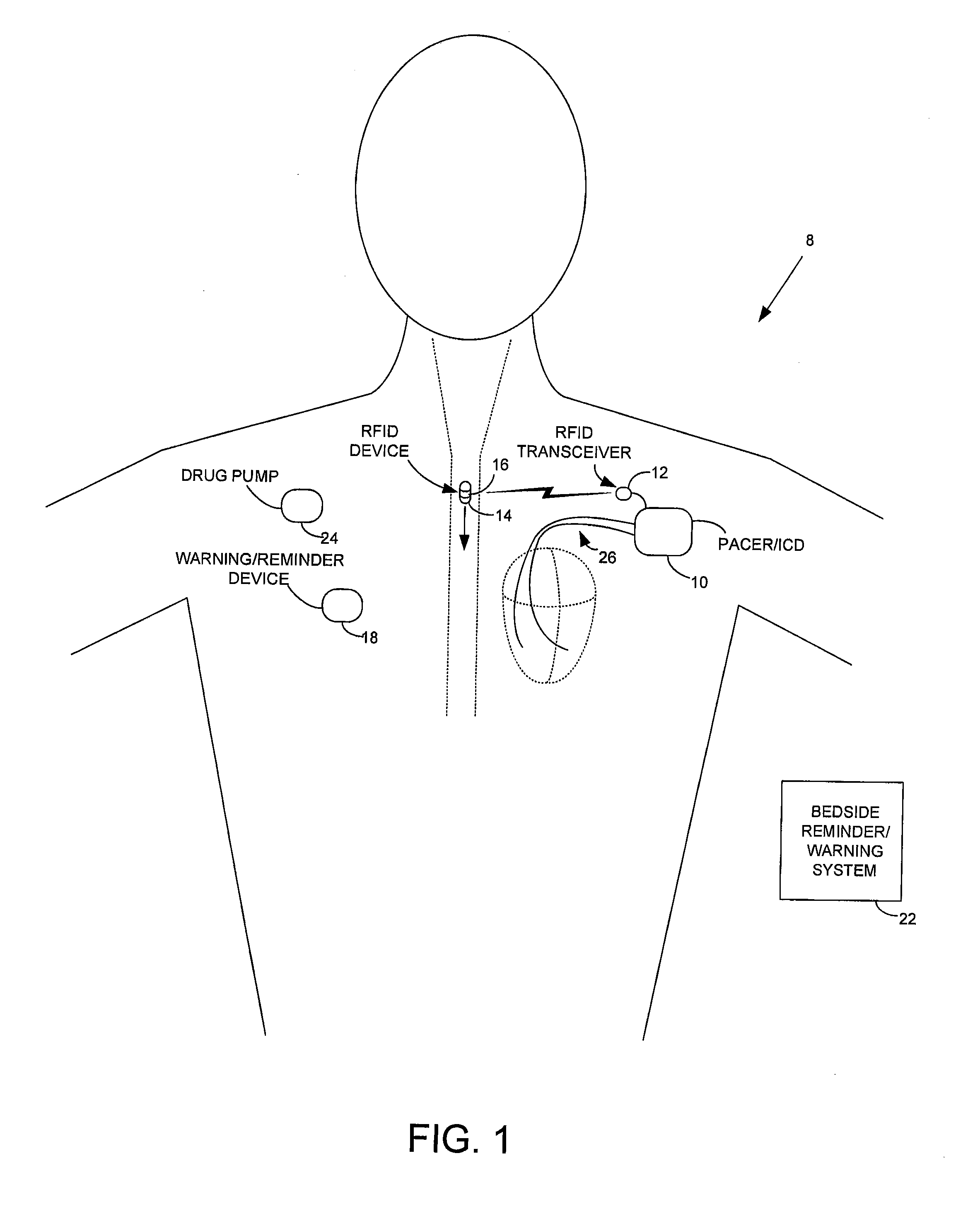 Method and apparatus for monitoring ingestion of medications using an implantable medical device