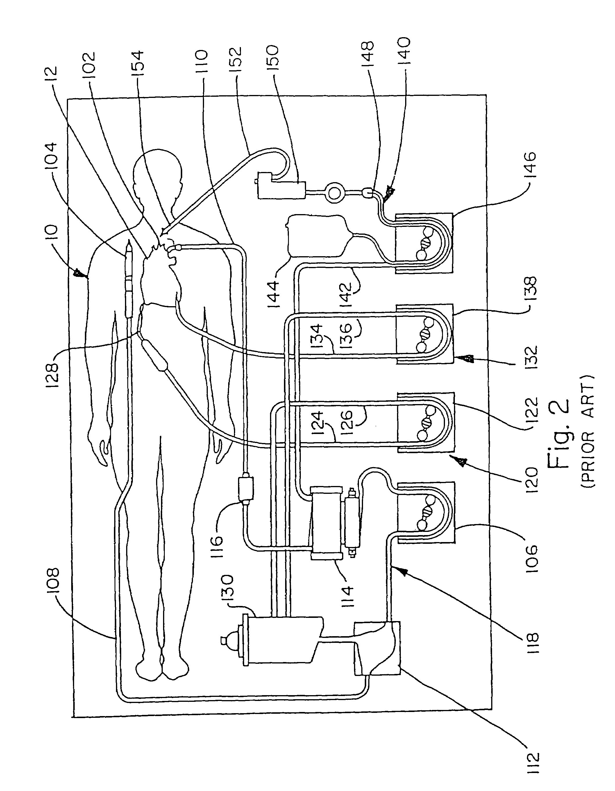 Method of recovering blood from an extracorporeal circuit