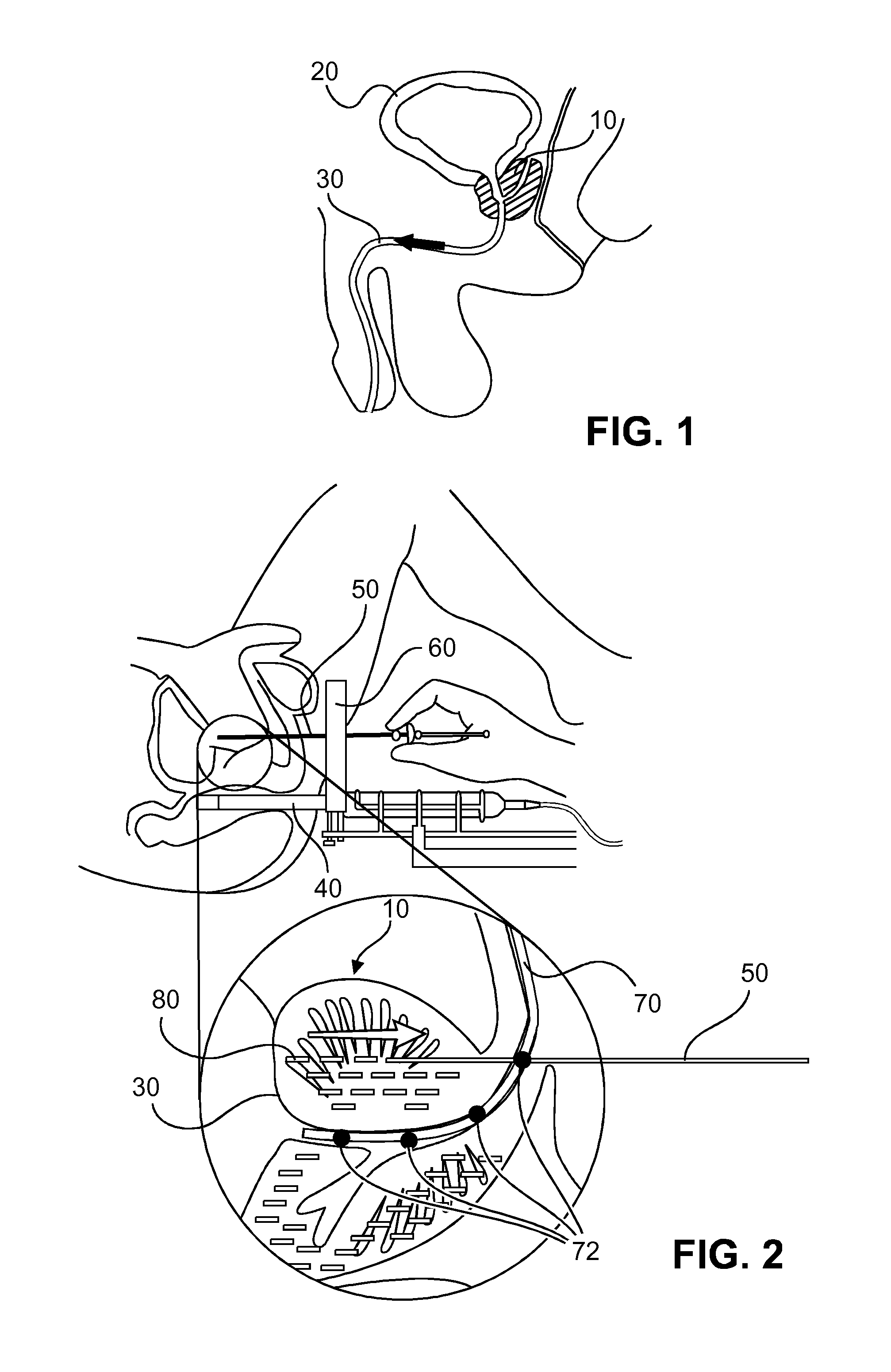 Method and system for localizing body structures