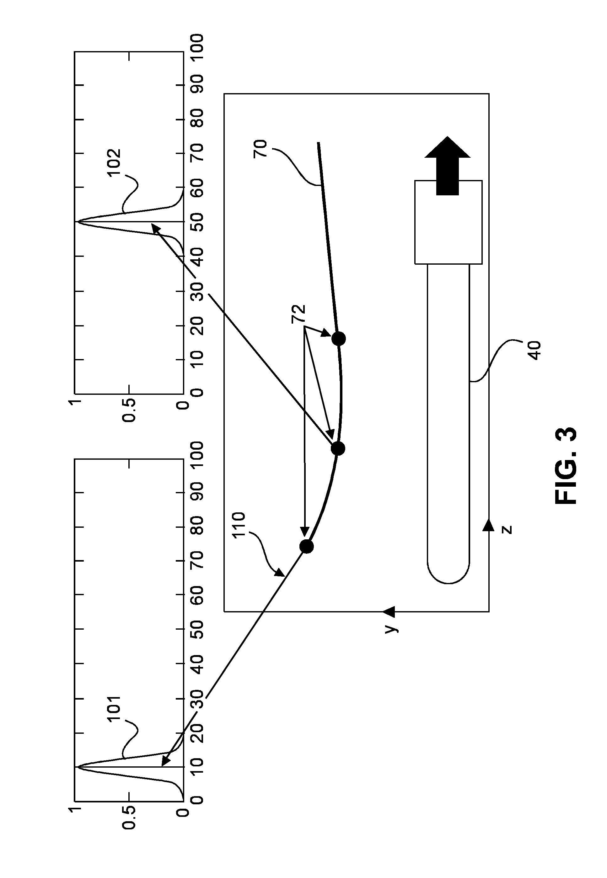 Method and system for localizing body structures