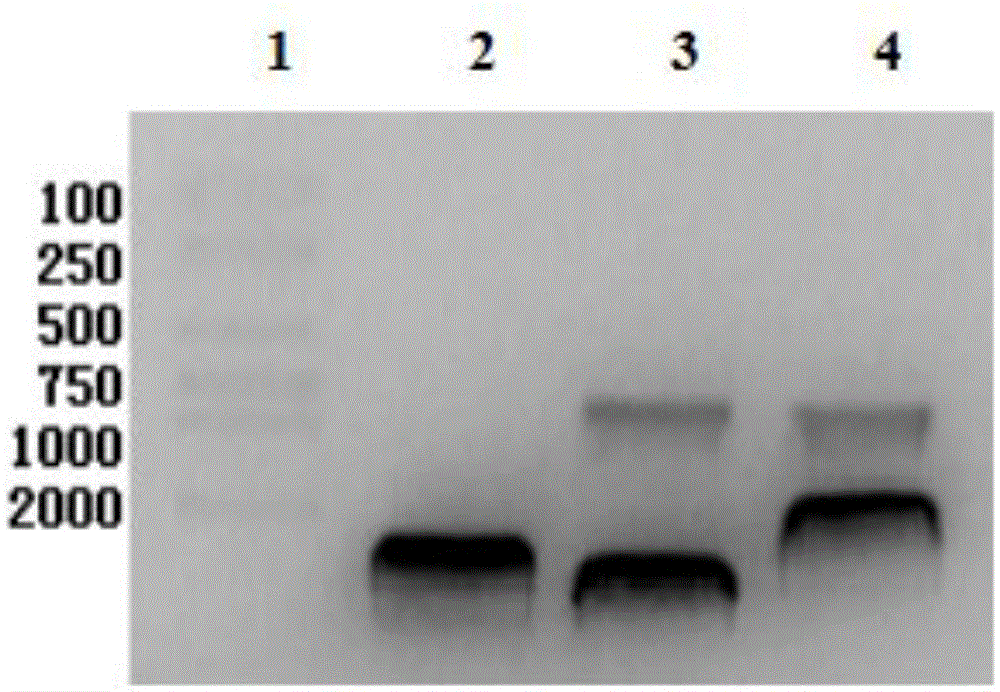 Construction of double-gene co-expression plasmid pEgr-IL18-B7.2 and application of double-gene co-expression plasmid pEgr-IL18-B7.2 to radiation-combined tumor resisting