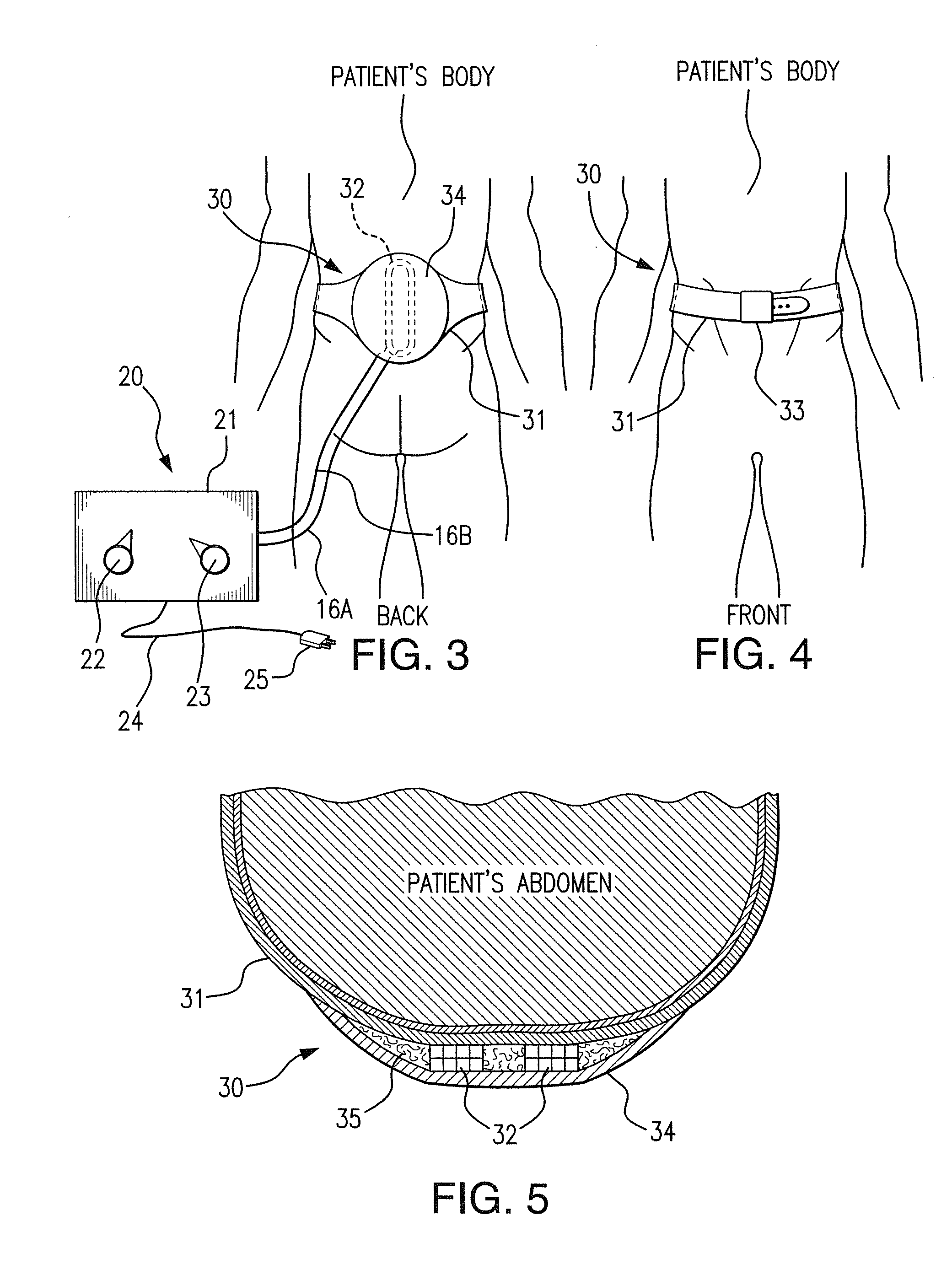 Electrical pulse generator to create magnetic pulses for the treatment of pain