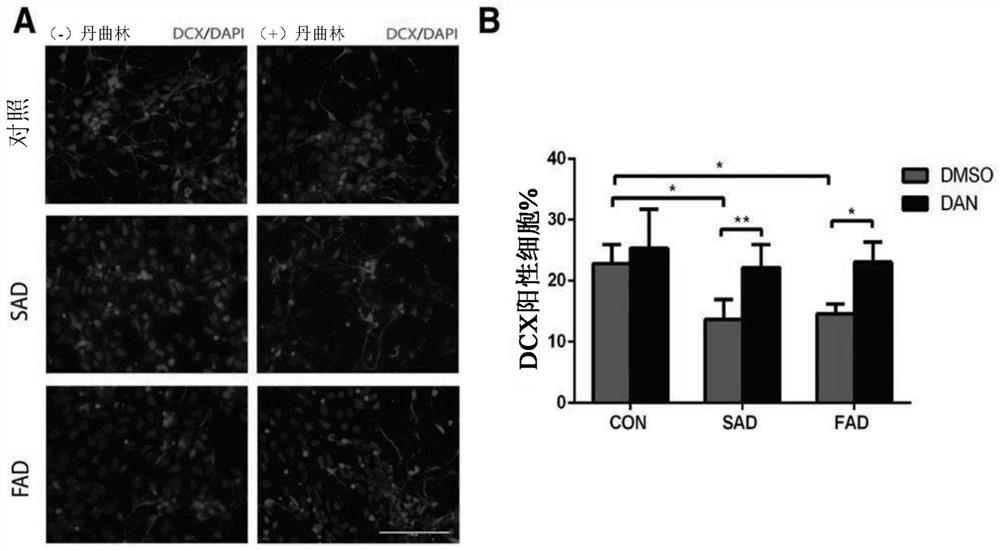 Intranasal Dantroline Administration For The Treatment Of Alzheimer Disease