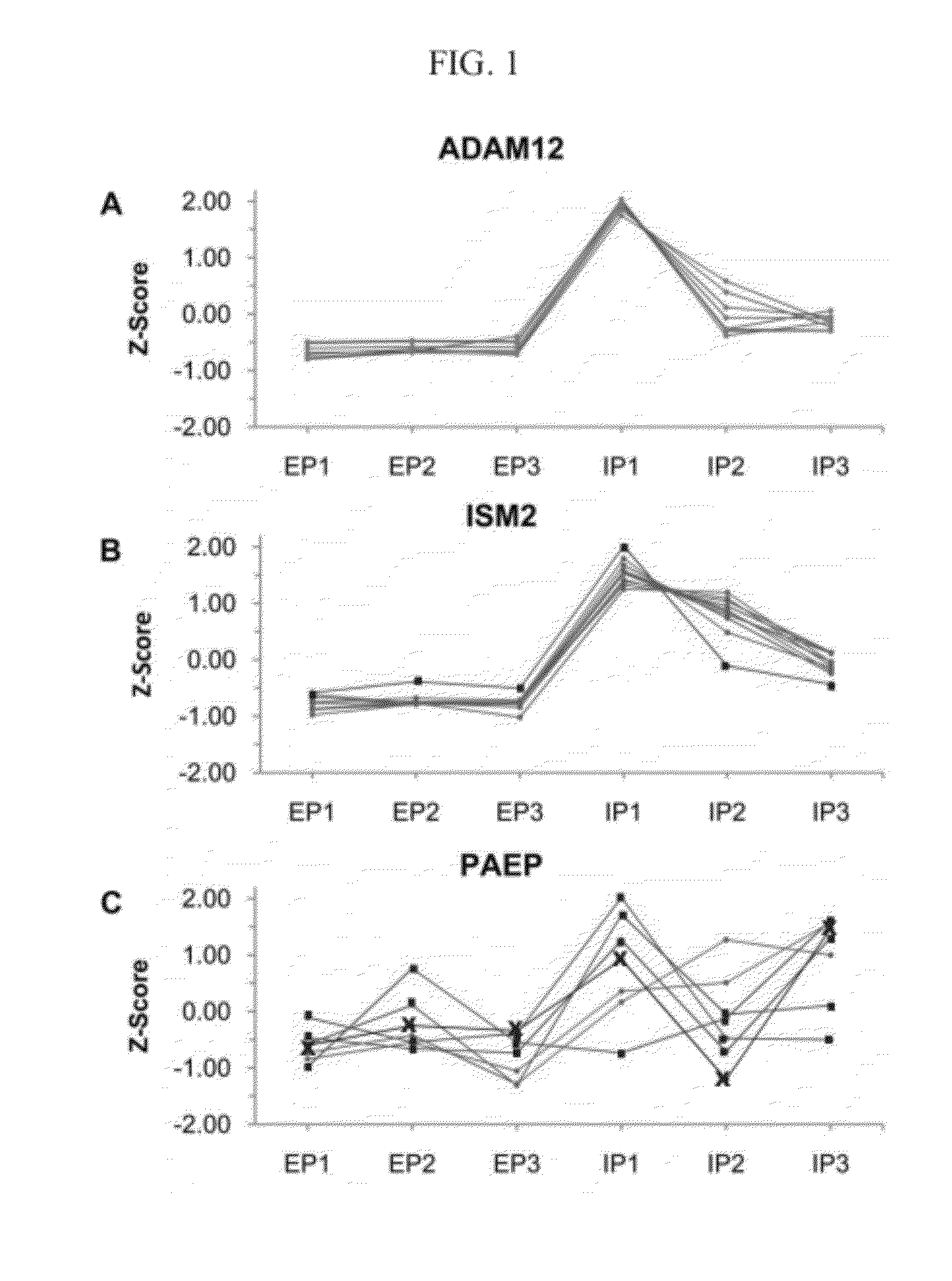 Methods and compositions for diagnosis of ectopic pregnancy