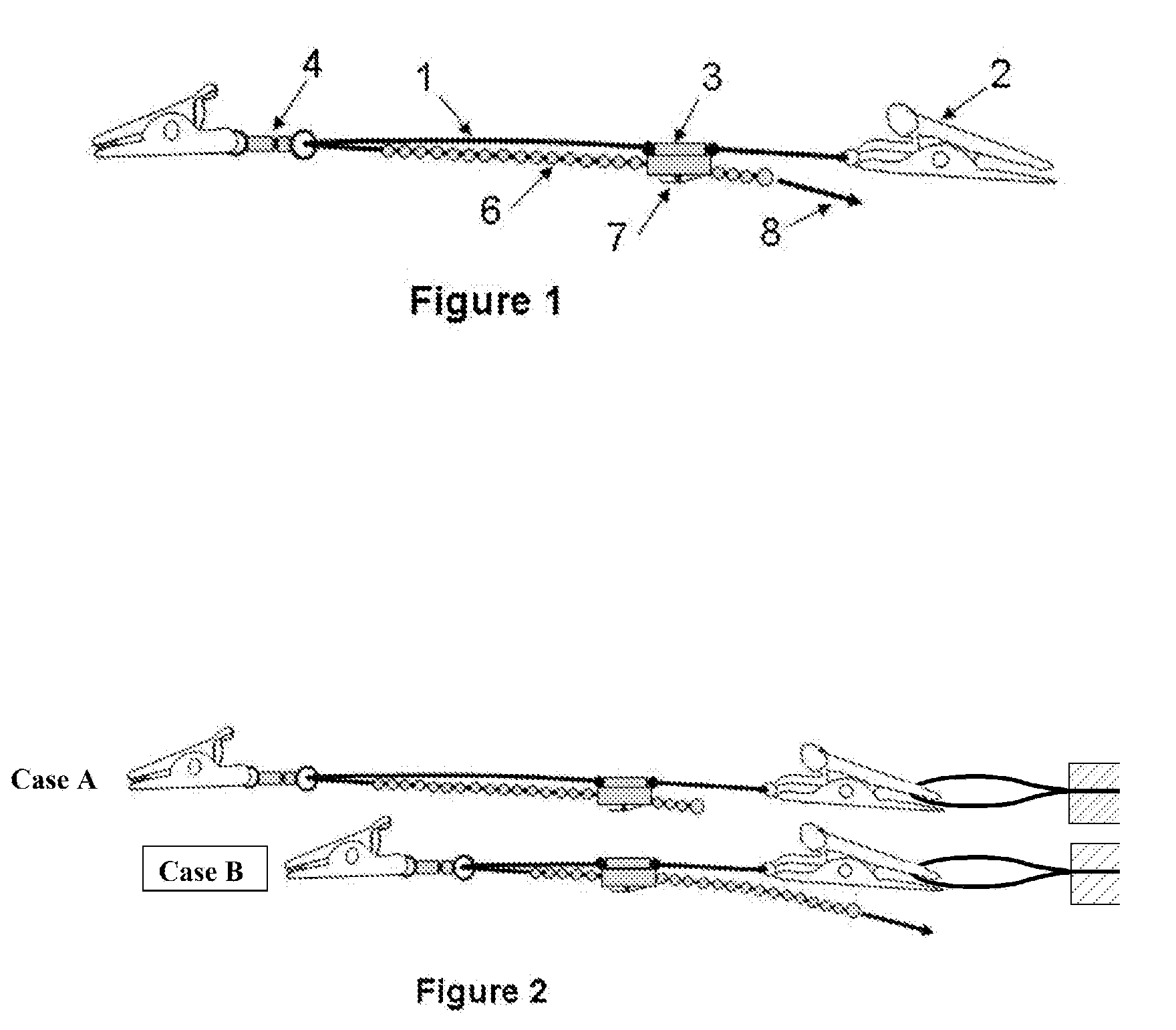 Adjustable Line and Net Retractors