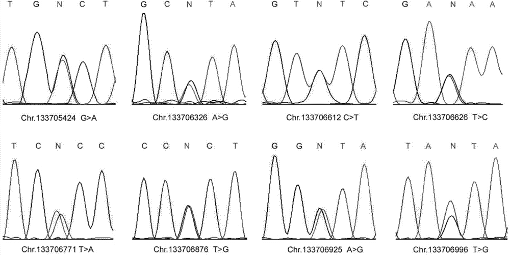 Male infertility related genetic marker