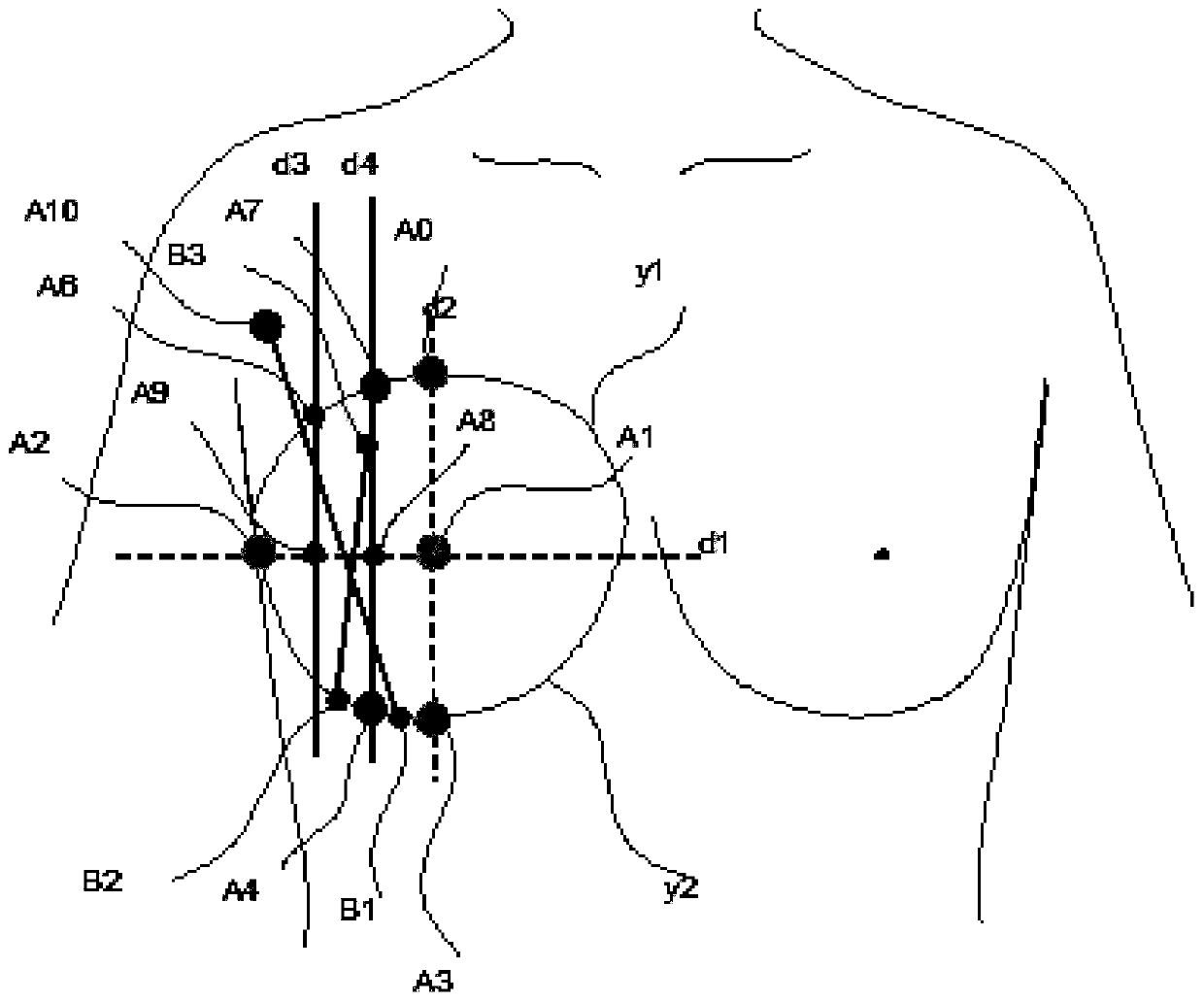 Garment with bra cups