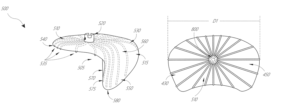 Device, system, and method for transcatheter treatment of valvular regurgitation