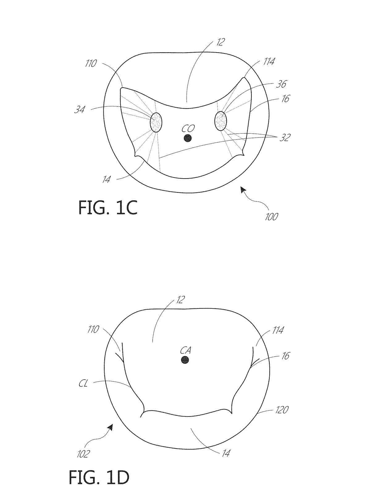 Device, system, and method for transcatheter treatment of valvular regurgitation