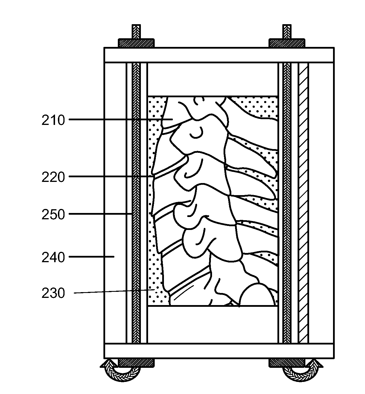 Human Surrogate Neck Model