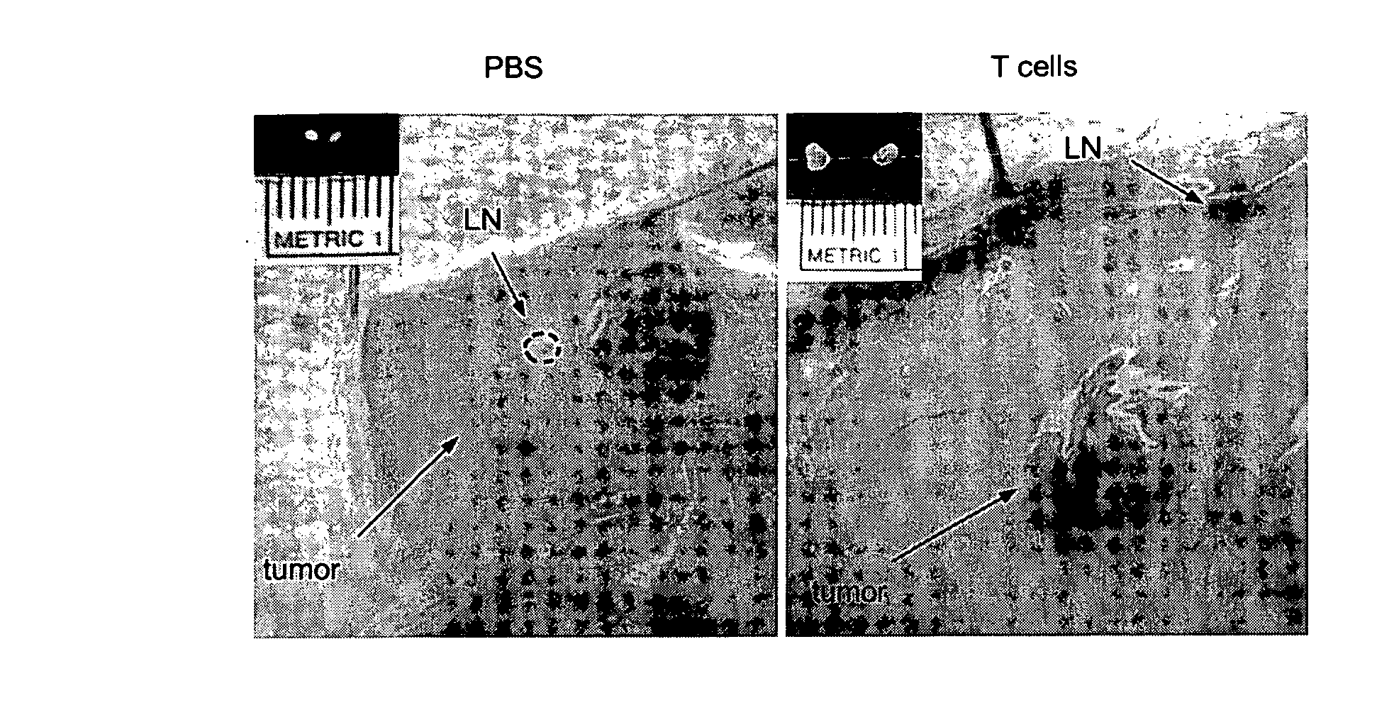 Compositions and methods for the treatment of cancer