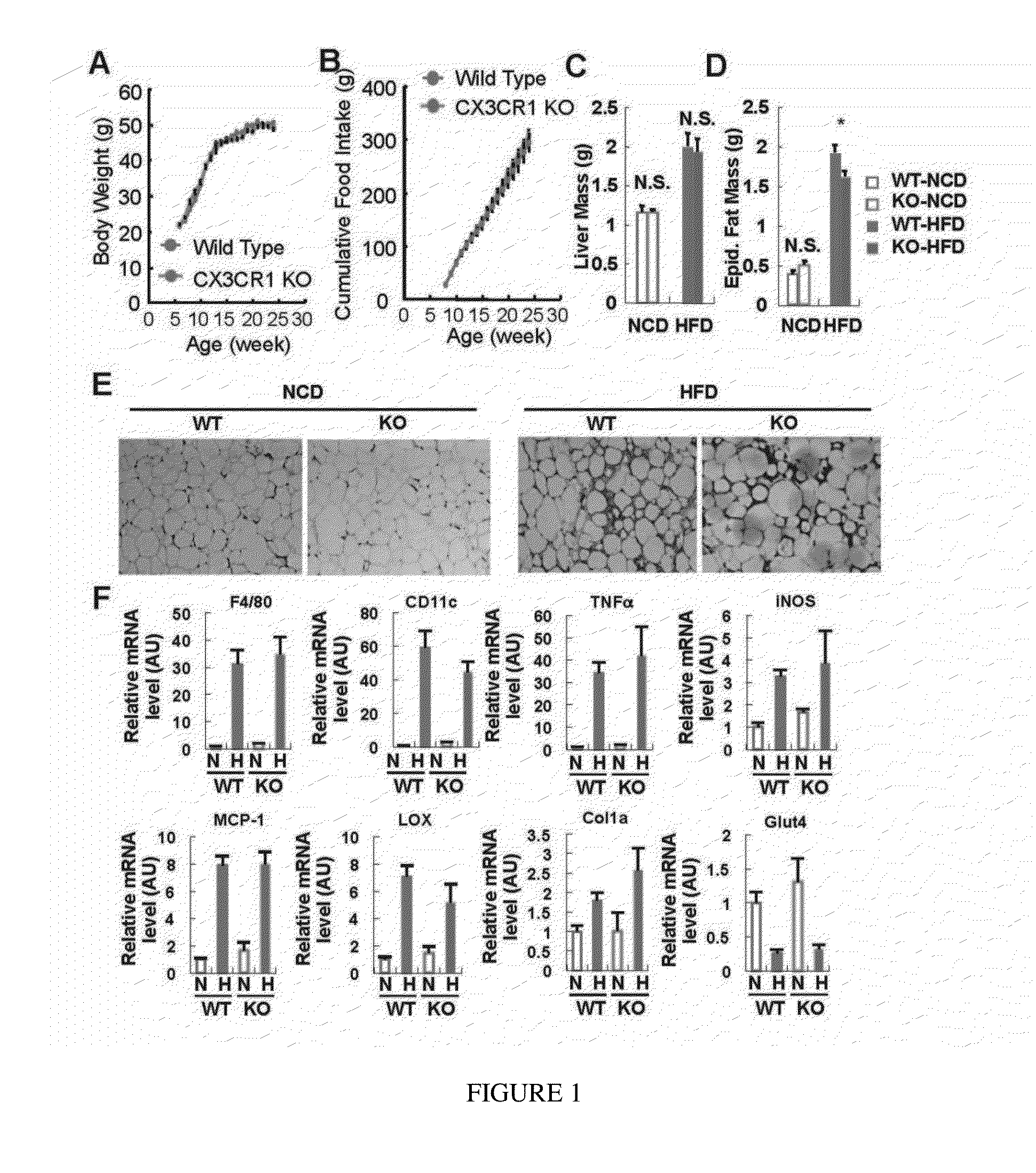 Novel Target for Diagnosis and Treatment of Diabetes and Cardiovascular Diseases