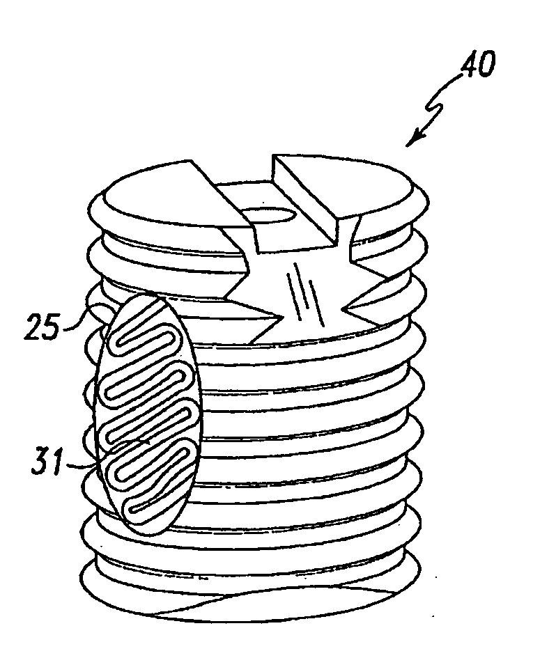 Bone grafts