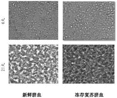 In-vitro expansion method, kit and application of umbilical cord blood NK (nature killer) cells