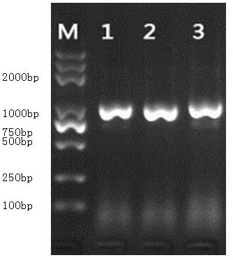 Amplification method of SARS-CoV-2 coronavirus antibody light chain full-length sequence