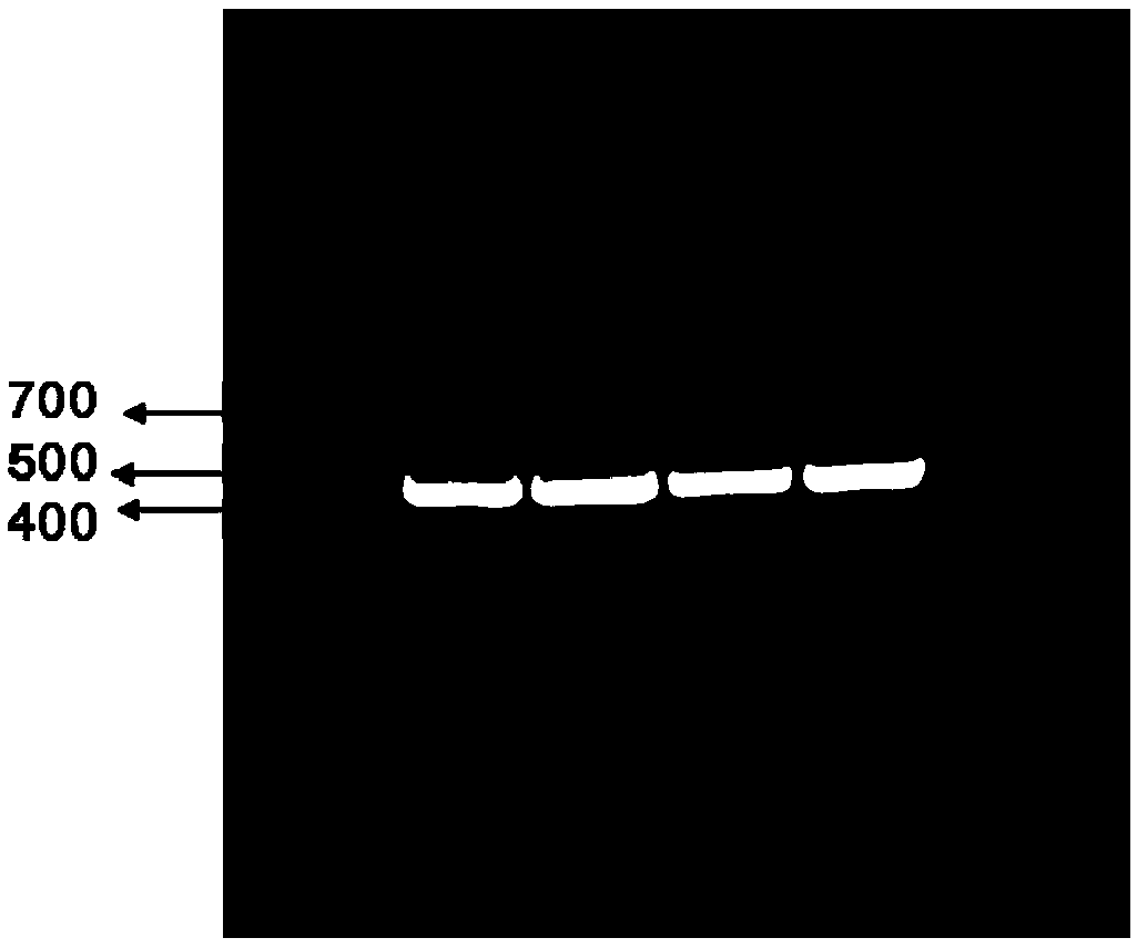 Recombinant adeno-associated virus expressing IL-4 and preparation method and application thereof