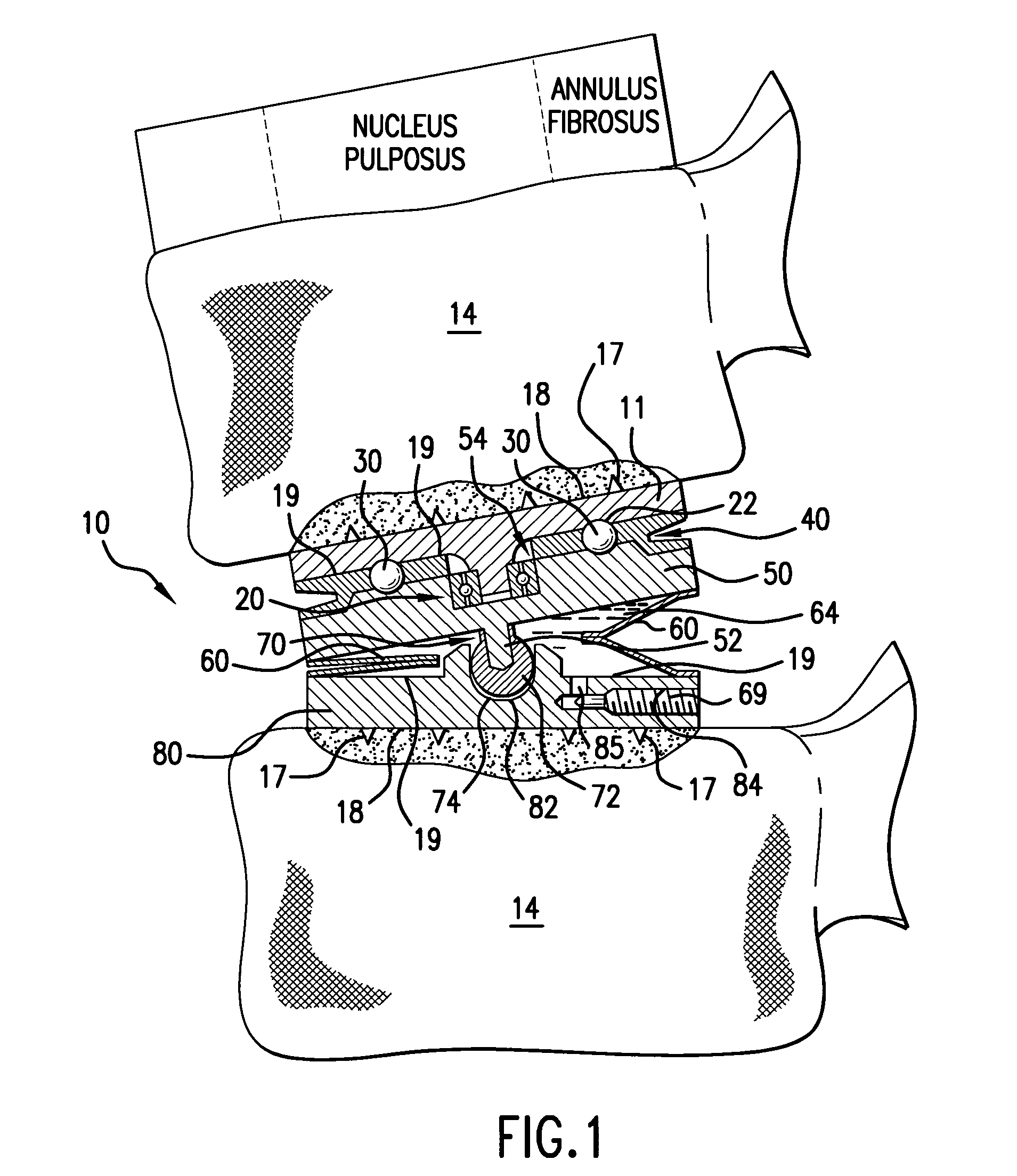 Rotatable and reversibly expandable spinal hydraulic prosthetic device