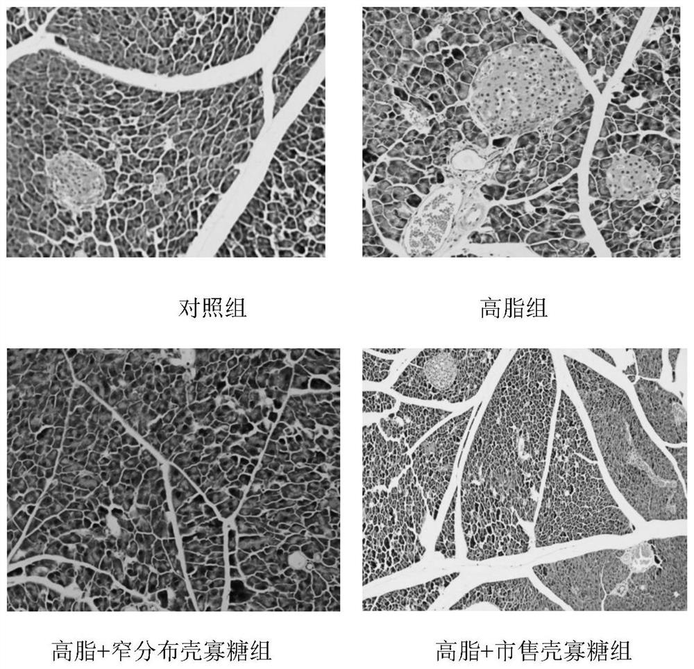 Application of narrowly distributed chitosan oligosaccharides in the preparation of functional foods for the prevention of long-term high-fat diet-induced hyperglycemia