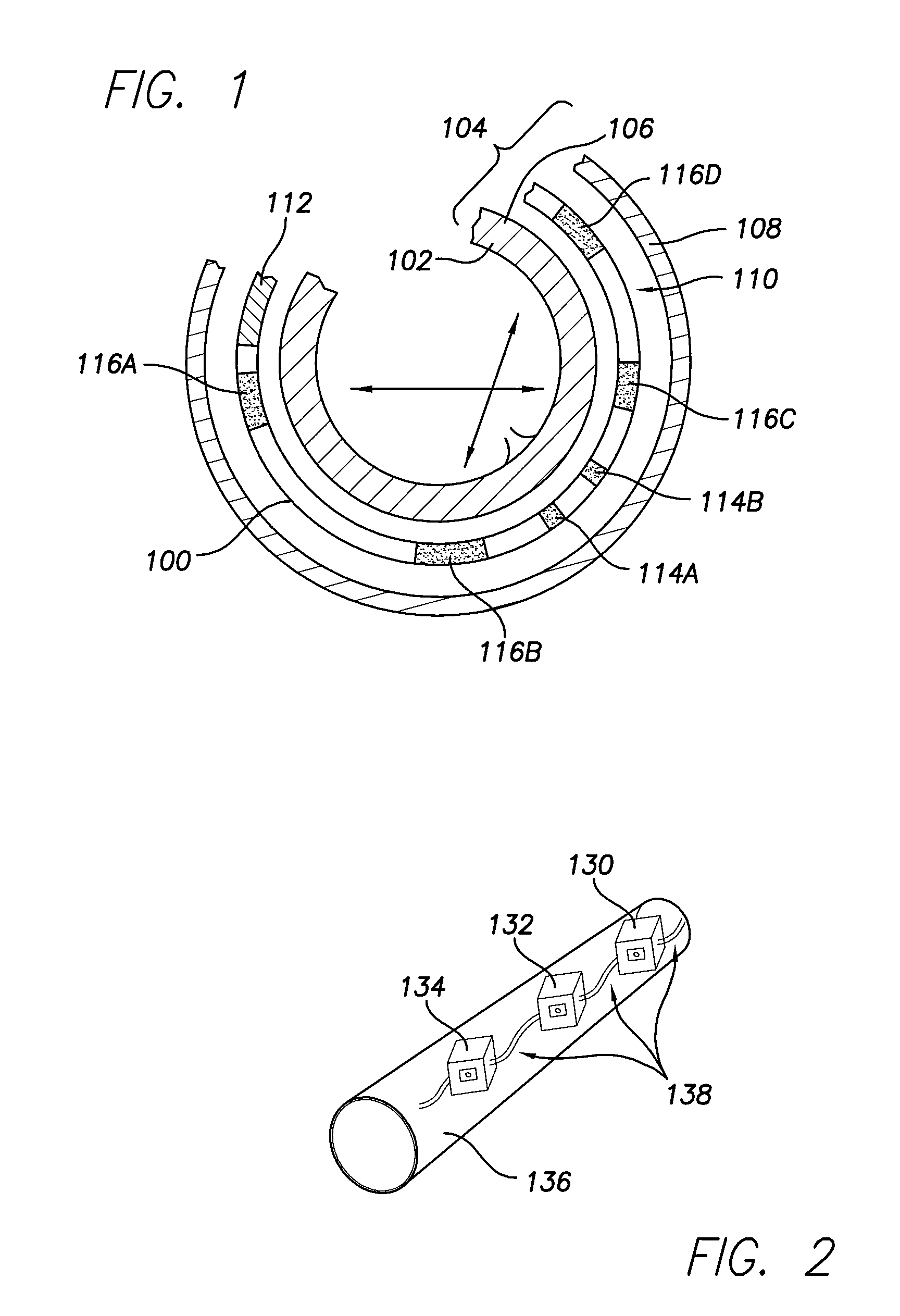 Pericardial cardioverter defibrillator