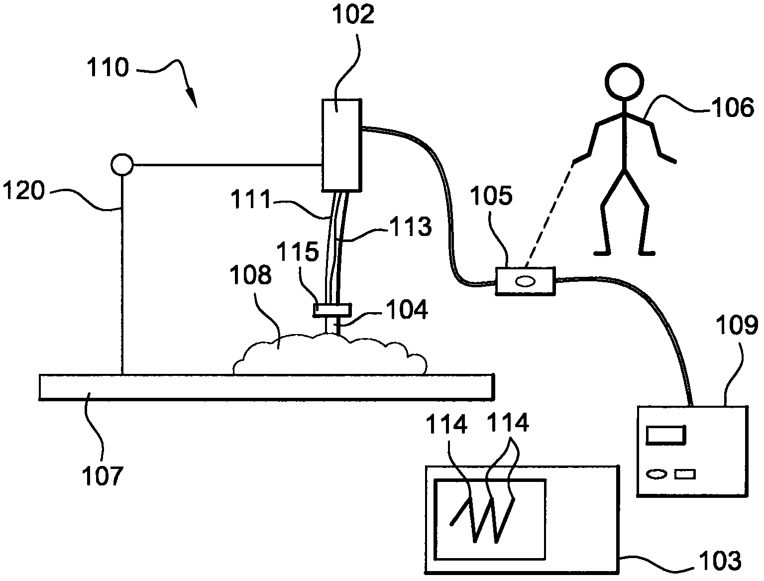 Elastography device and method