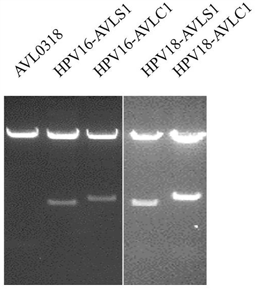 Novel HPV therapeutic nucleic acid vaccine