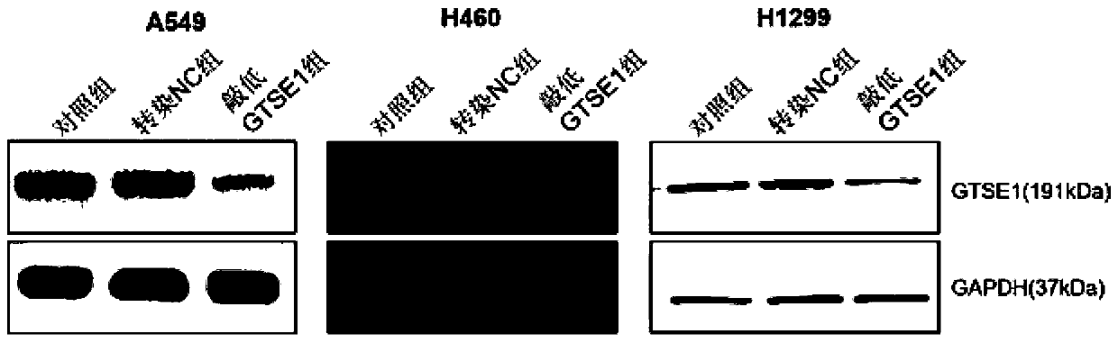 Application of reagent for inhibiting or down-regulating expression of GTSE1 gene in preparation of tumor radiotherapy sensitization drug