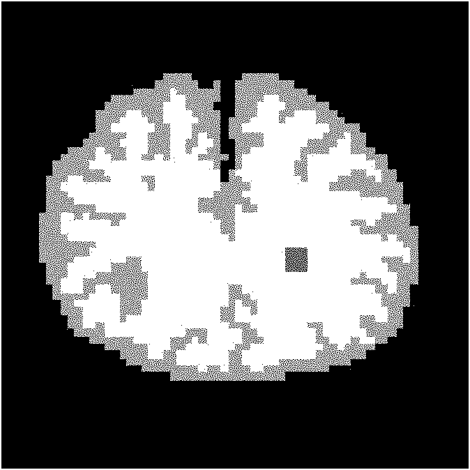 Regional spatial-temporal prior-based dynamic PET reconstruction method