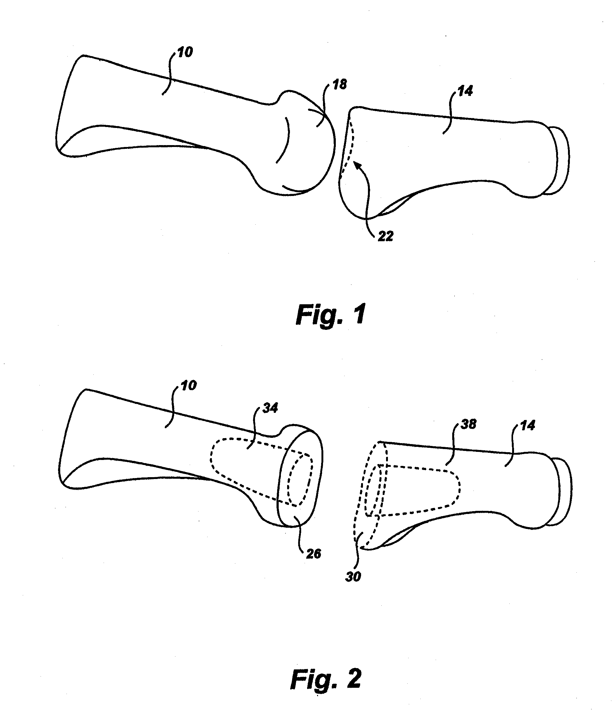 Artificial toe joint