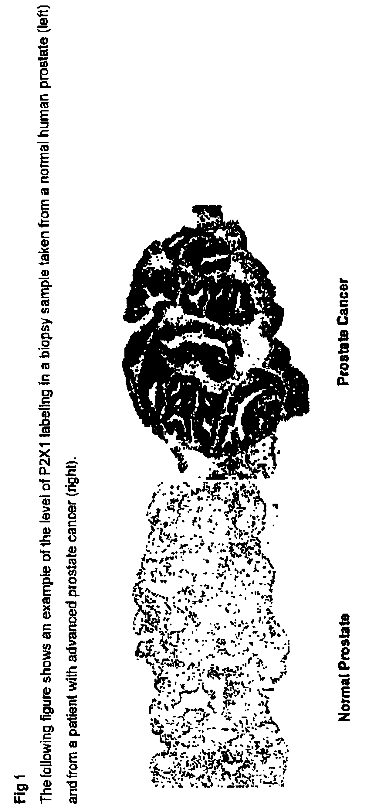 Method for identifying pre-neoplastic and/or neoplastic states in mammals