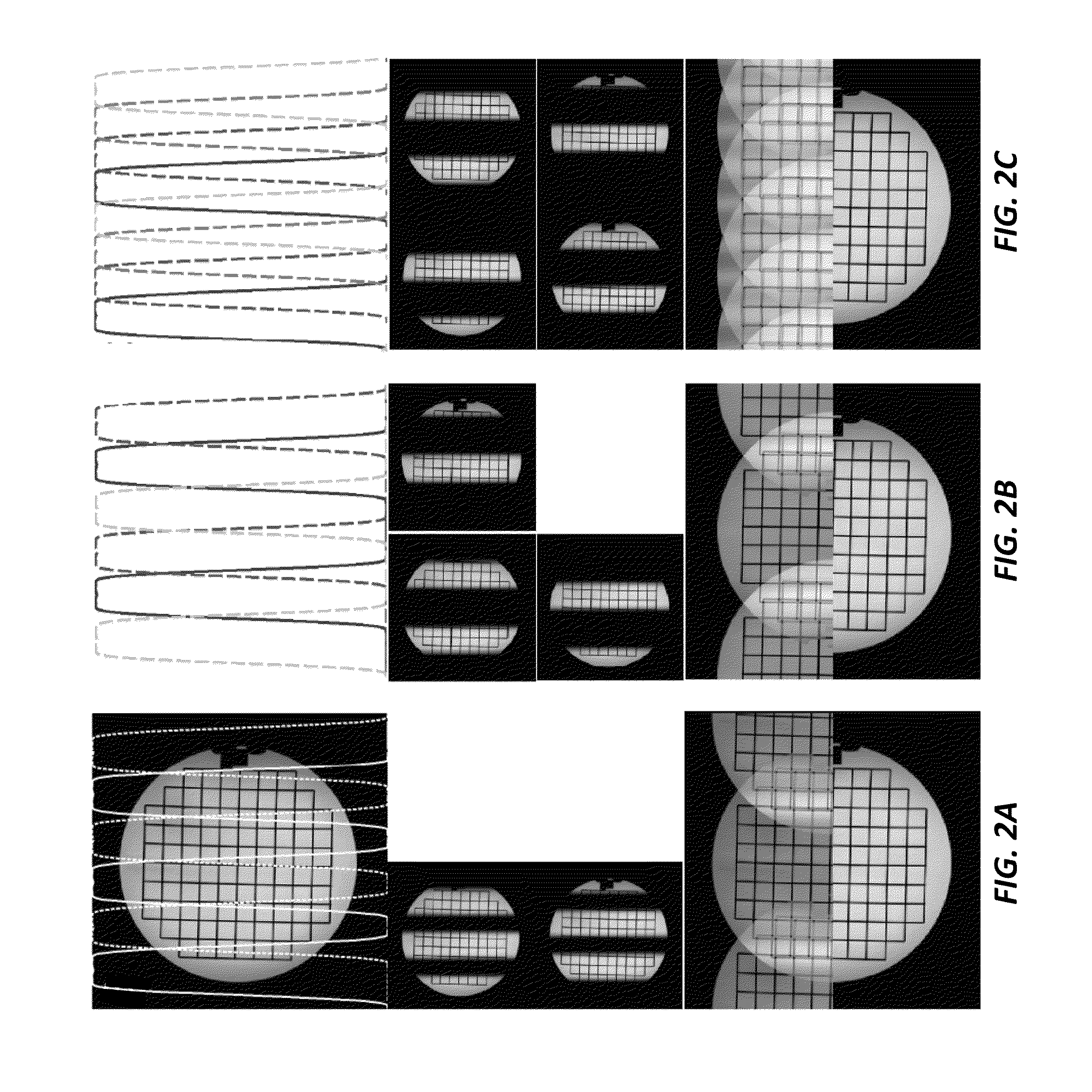 High Resolution Magnetic Resonance Imaging with Reduced Distortion Based on Reduced-Field-of-View and Generalized Parallel Imaging