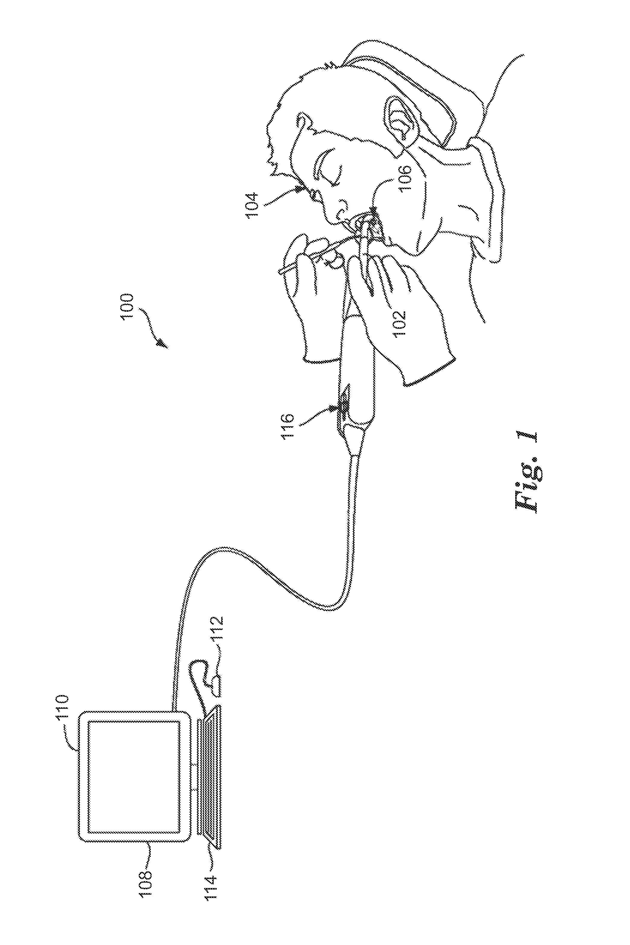 Fabrication of dental articles using digitally-controlled reductive and digitally-controlled additive processes