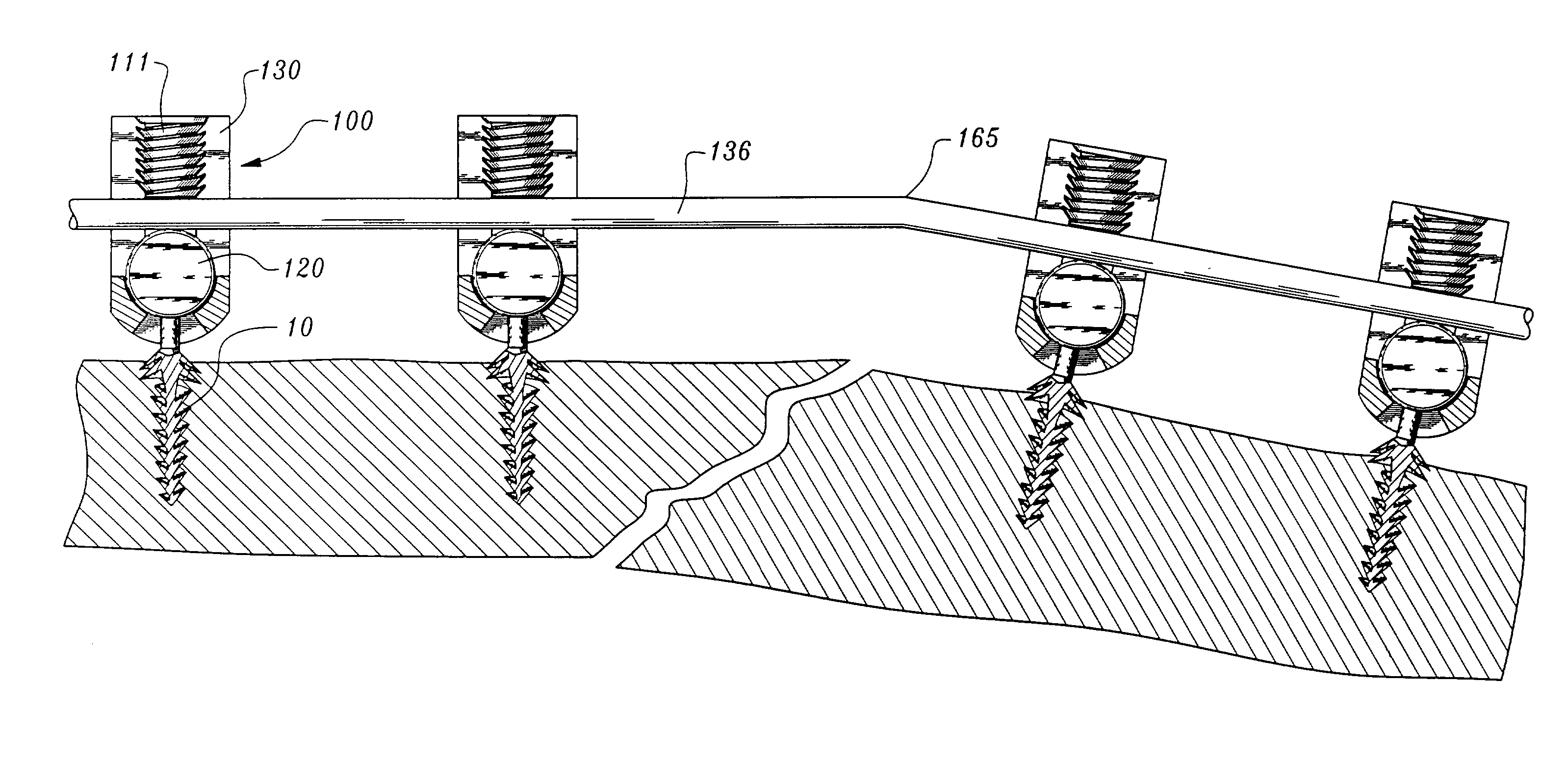 Orthopedic stabilization device and method