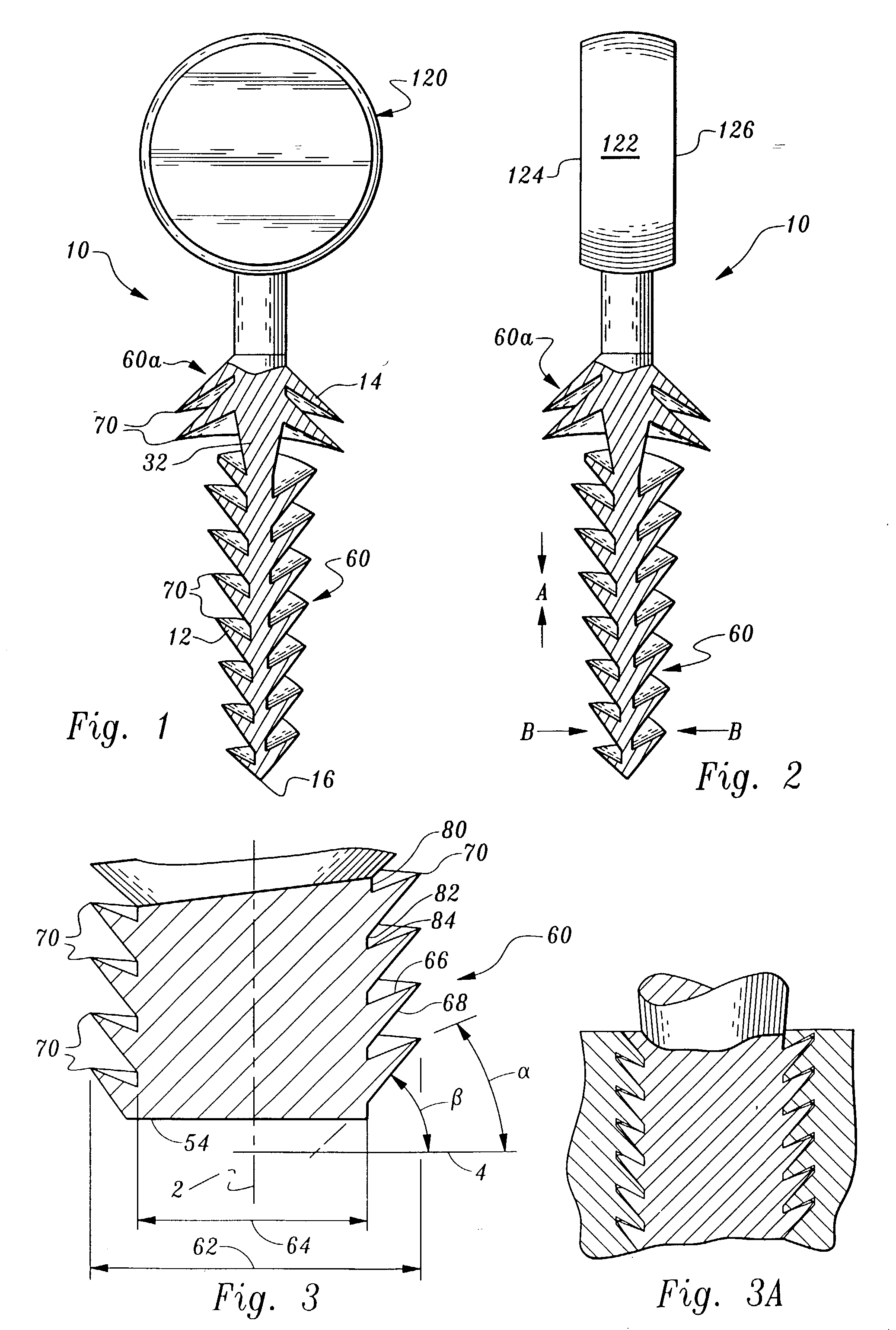 Orthopedic stabilization device and method