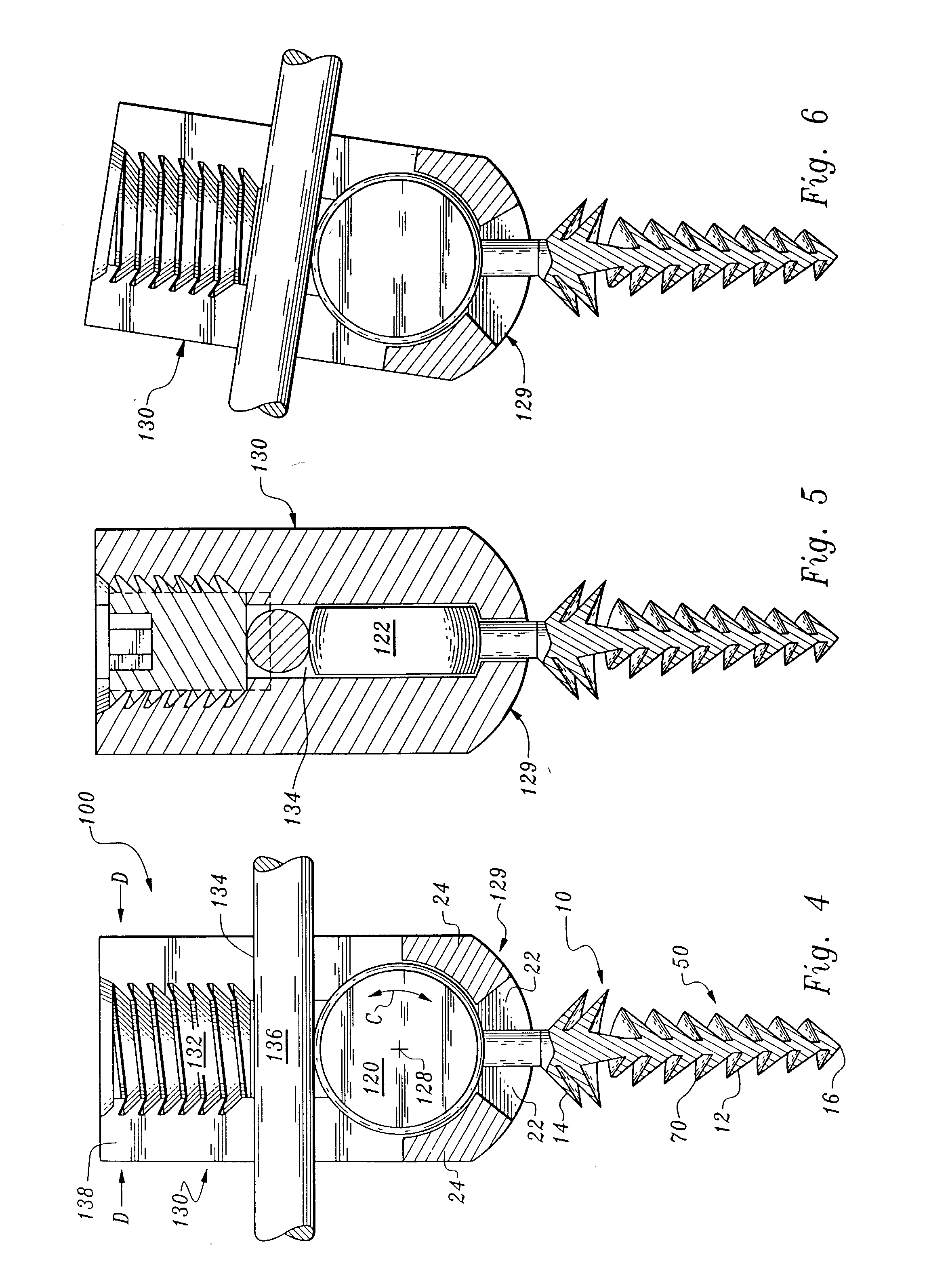 Orthopedic stabilization device and method