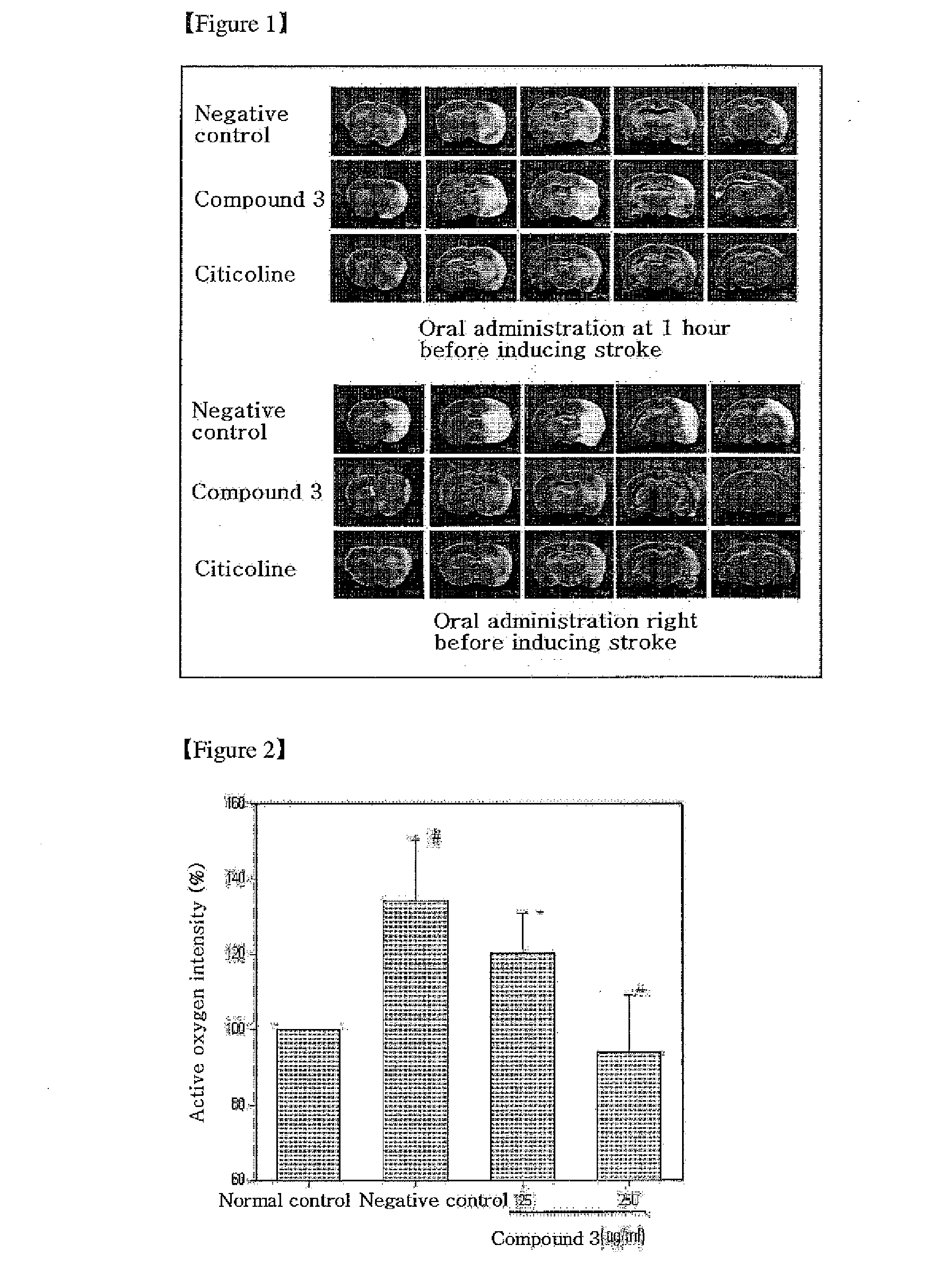 Novel quinazoline-2,4-dione derivative, and medical compositions for the prophylaxis and treatment of cranial nerve disease containing the same