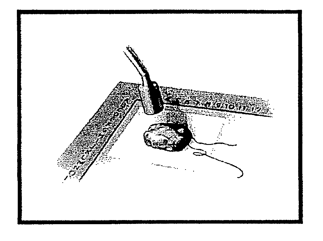 Radio guided seed localization of imaged lesions