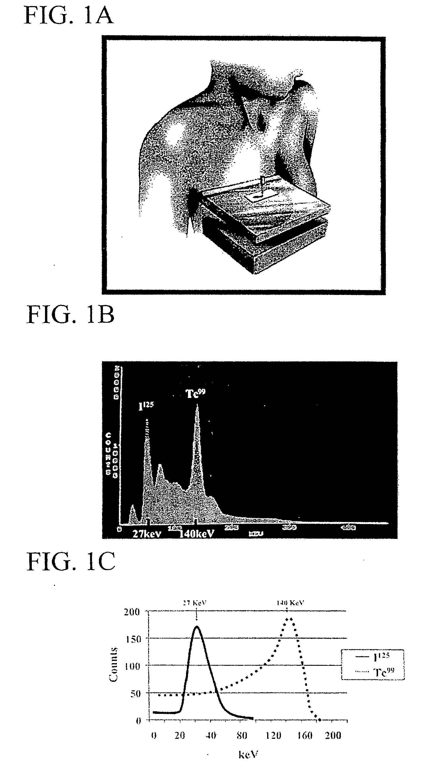 Radio guided seed localization of imaged lesions