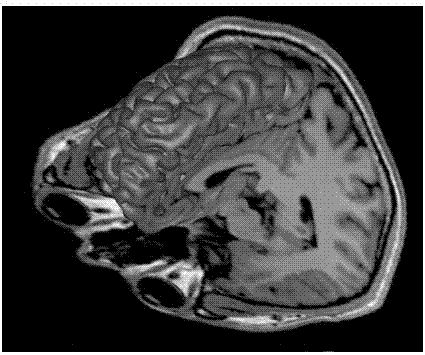 Method for constructing three-dimensional brain model