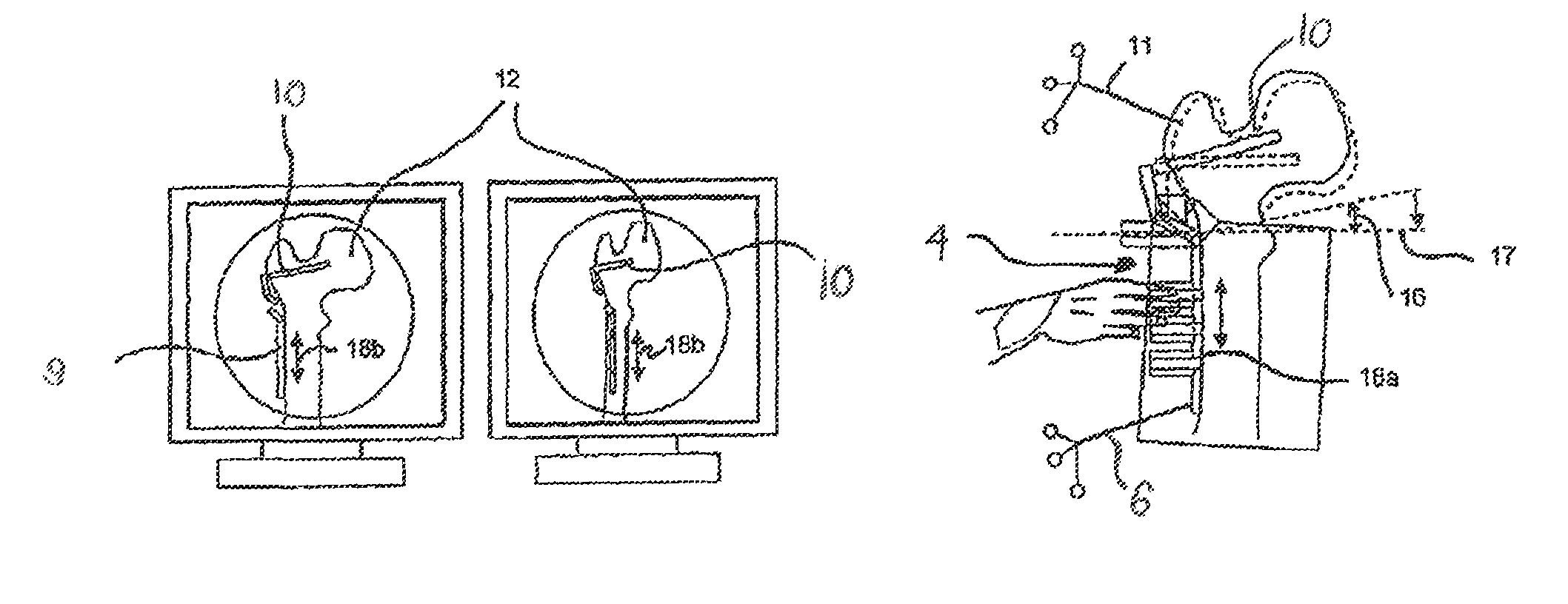 Implant location positioning system