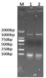 Cell-adapted strain of supervirulent chicken infectious bursal disease virus and its application