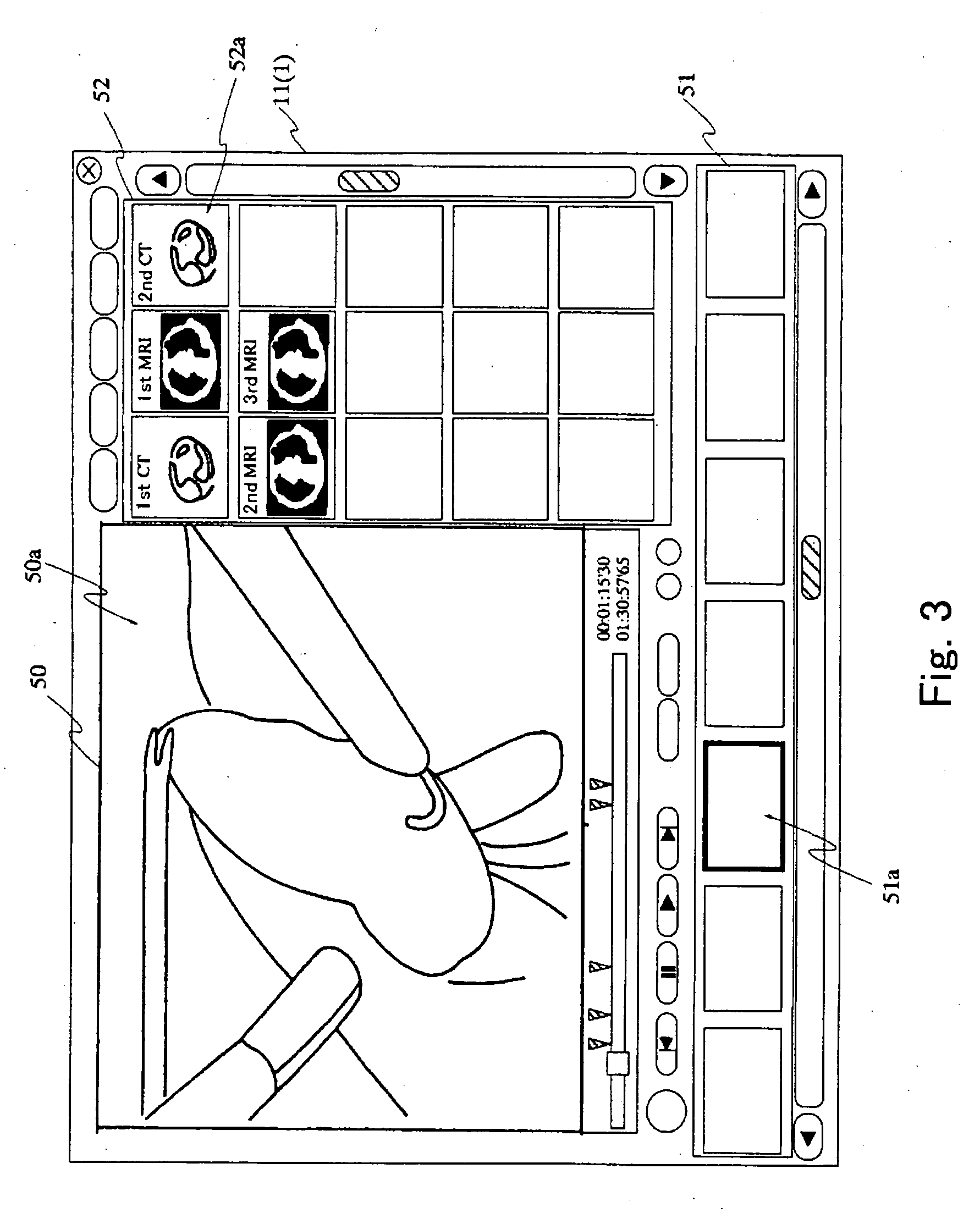 Medical information processing system